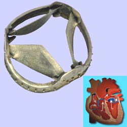Herzklappenprothese (bestehend aus Herzklappenring und drei Herzklappenflügeln)